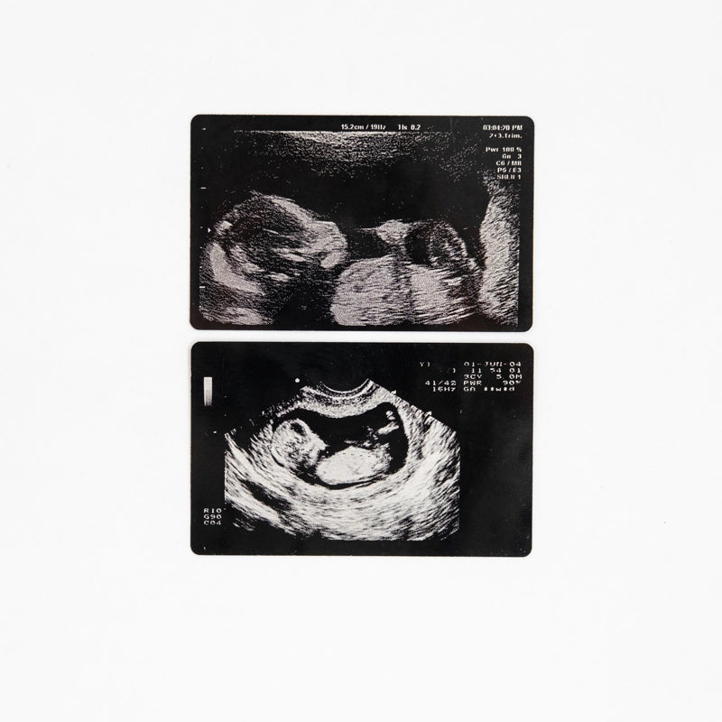 Baby scans laser engraved onto aluminium cards