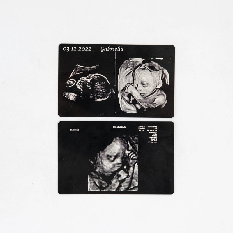 Baby scans laser engraved onto aluminium cards