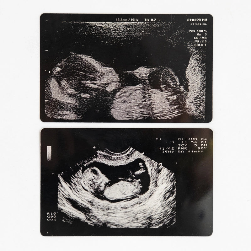 Baby scans laser engraved onto aluminium cards