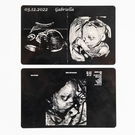 Baby scans laser engraved onto aluminium cards